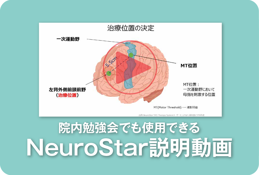 NeuroMyStar（ニューロマイスター）説明動画